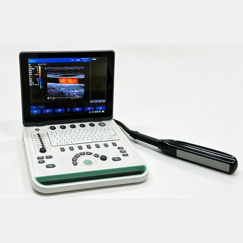 Scanner ecografico portatile