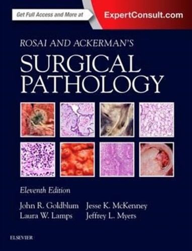 Rosai ackermans surgical - &,