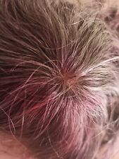 +offerta+ Protesi capelli uomo skin iniettato sottile