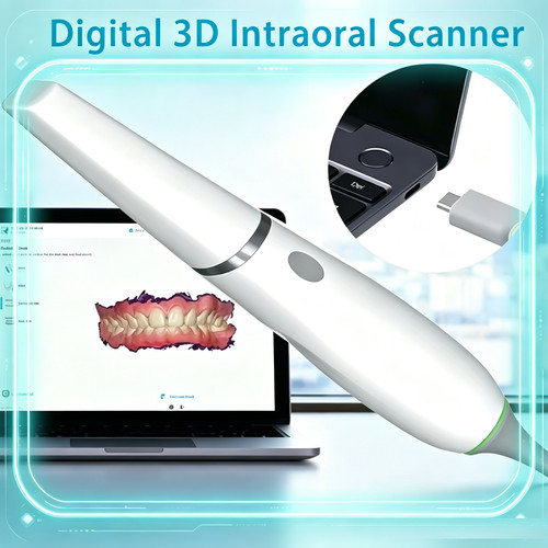 Scanner intraorale dentale