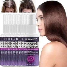 10/8pz Minoxidil 2% Donna