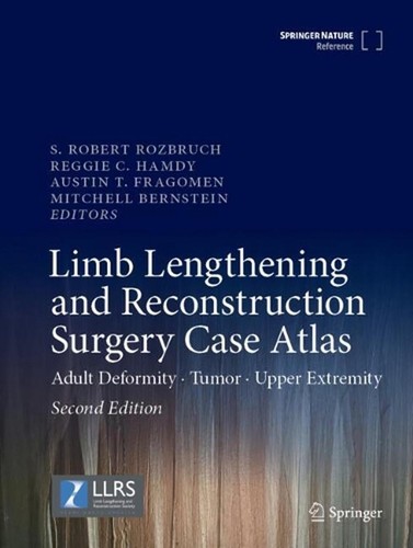 Limb lengthening and - lengthening,