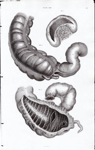 Organi interni acquaforte - organi, interni,
