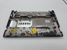Scocca per Asus Eee PC 1025C