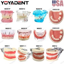 Modello denti dentali USA orto
