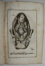 OSTETRICIA – fig. 1816 – Stein – medicina – 19 TAVOLE - parto