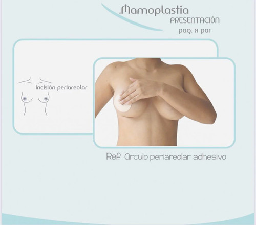Adesivo mamoplastia areolare - mamoplastia,