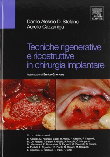 Tecniche rigenerative - , e