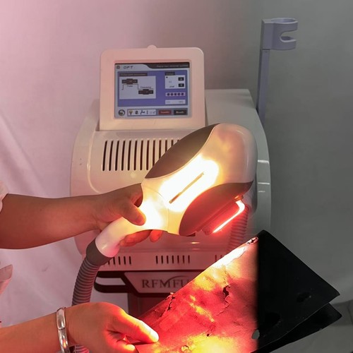 Pro opt elight ipl laser - pro,