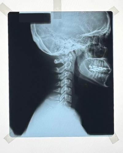 Vintage authentic xray - authentic,