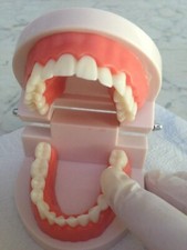 Protesi dentaria modello