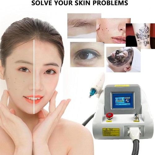 Yag laser rimozione - nd,