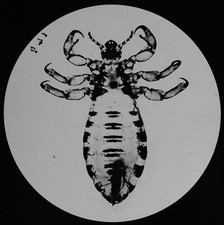 HUMAN BODY LOUSE C1890