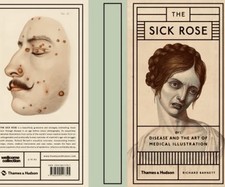 The sick rose - and,