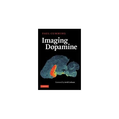 Imaging dopamine paul cumming - paul,