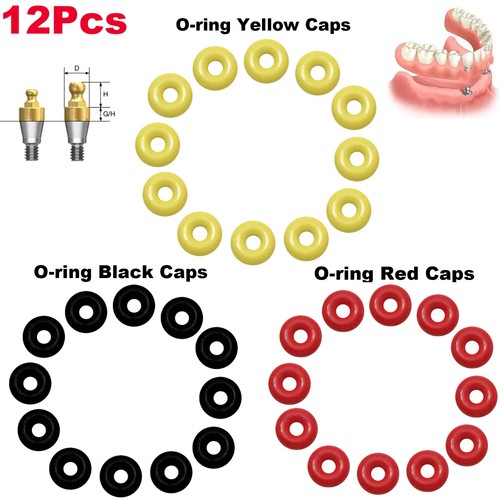 Kit ritenzione ring - ritenzione, o-ring