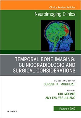 Temporal bone imaging - bone,
