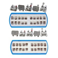 Staffa metallica ortodontica