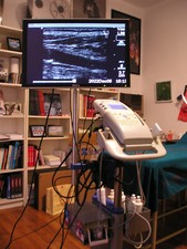 ECOGRAFO SONOSITE +3 SONDE +PRINTER SONY +MONITOR DELL FUNZIONA PERFETTO!