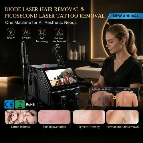 Depilazione laser diodi in - a,