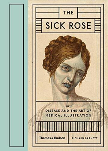 The sick rose disease and - rose:,