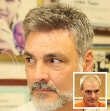 Capelli sostituzione capelli