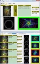 RADIONICA MALCOM RAE MEDICAL SW 