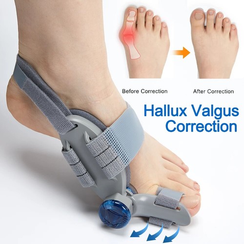 Bunion fix toe valgus - bunion,