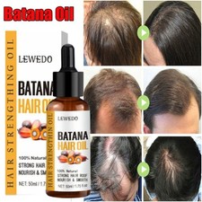 Olio di Batana Essenza per una