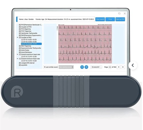 Wellue er1 ekg ecg - wellue,