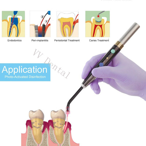 Sistema laser diodi - a, dentali