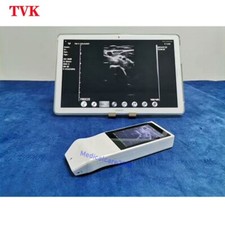 Scanner Ultrasuoni Lineare