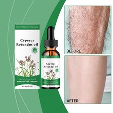 ✨Olio di Cipro Rotundus -