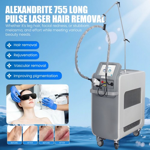 Macchina depilazione laser