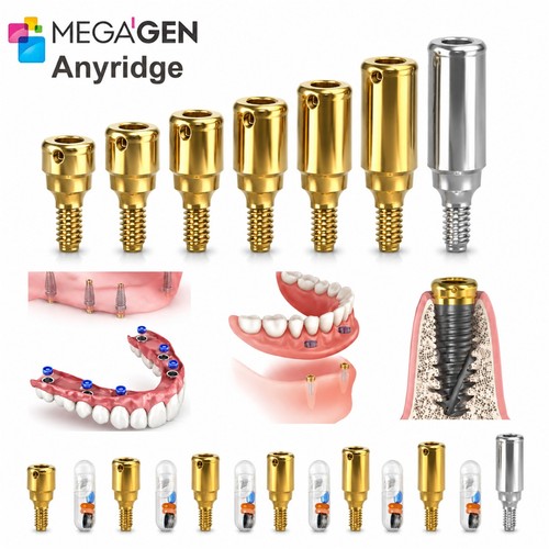 Zest locator overdenture - zest,