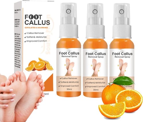 Spray rimozione calli - rimozione, piedi