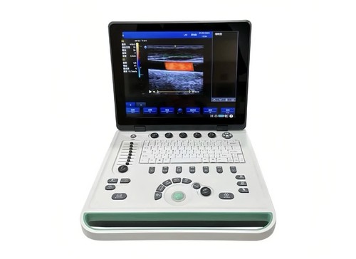 Scanner ultrasuoni portatile - ultrasuoni,