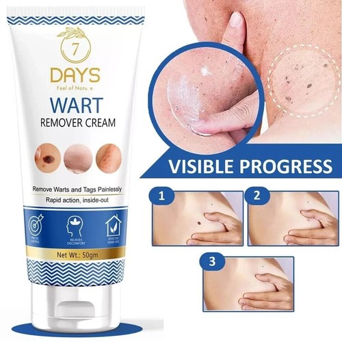 Crema per rimozione delle - crema,