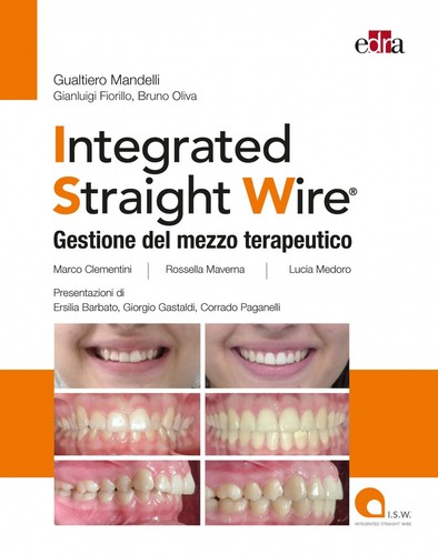Integrated straight wire