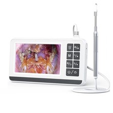 Otoscopio Digitale Otoscopio