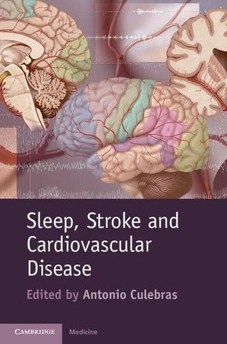 Sleep stroke and - stroke,