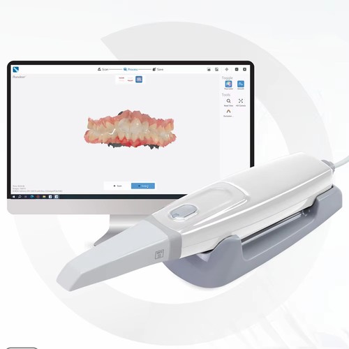 Scanner intraorale dentale