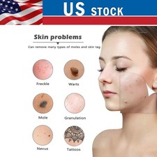 Penna al plasma laser