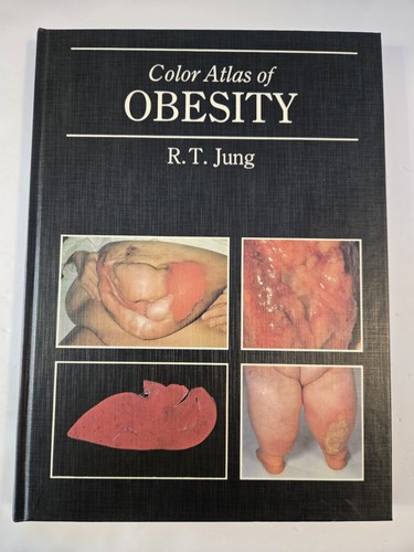 Color atlas obesity by - color,