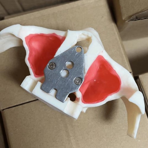 Impianto dentile sollevamento - impianto,
