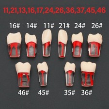 Modello denti canale