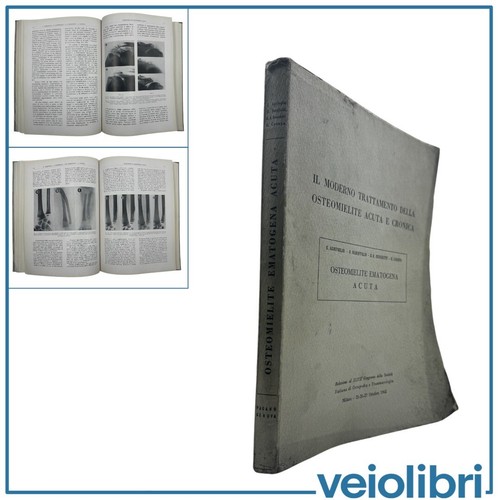 Ortopedia osteomielite - ortopedia,