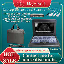 Scanner ad ultrasuoni digitale