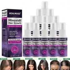 2% Minoxidil per Donna