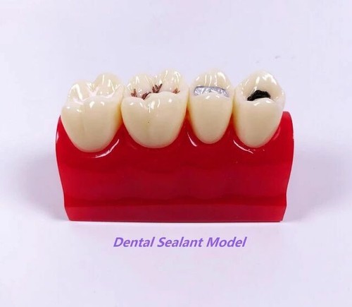 1pcs fessura - fessura,